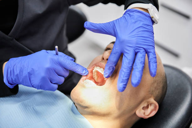 Best Emergency Treatment for Dental Infections or Abscesses in Stokesdale, NC