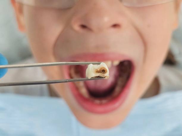 Best Emergency Gum Treatment in Stokesdale, NC
